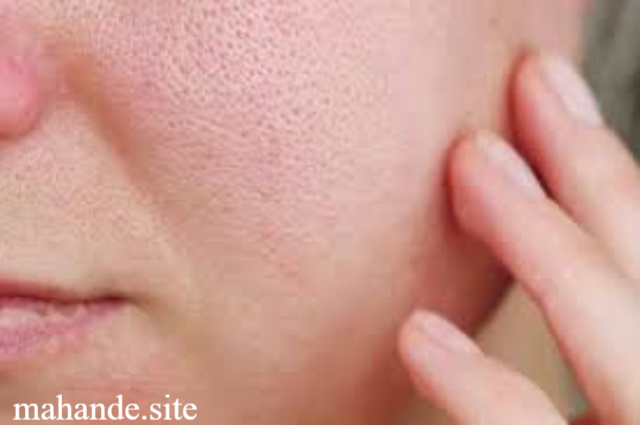 7 Cara Mengecilkan Pori-Pori Wajah secara Alami